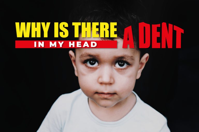 Why Is There A Dent In My Head - Exploring The Causes And Treatments